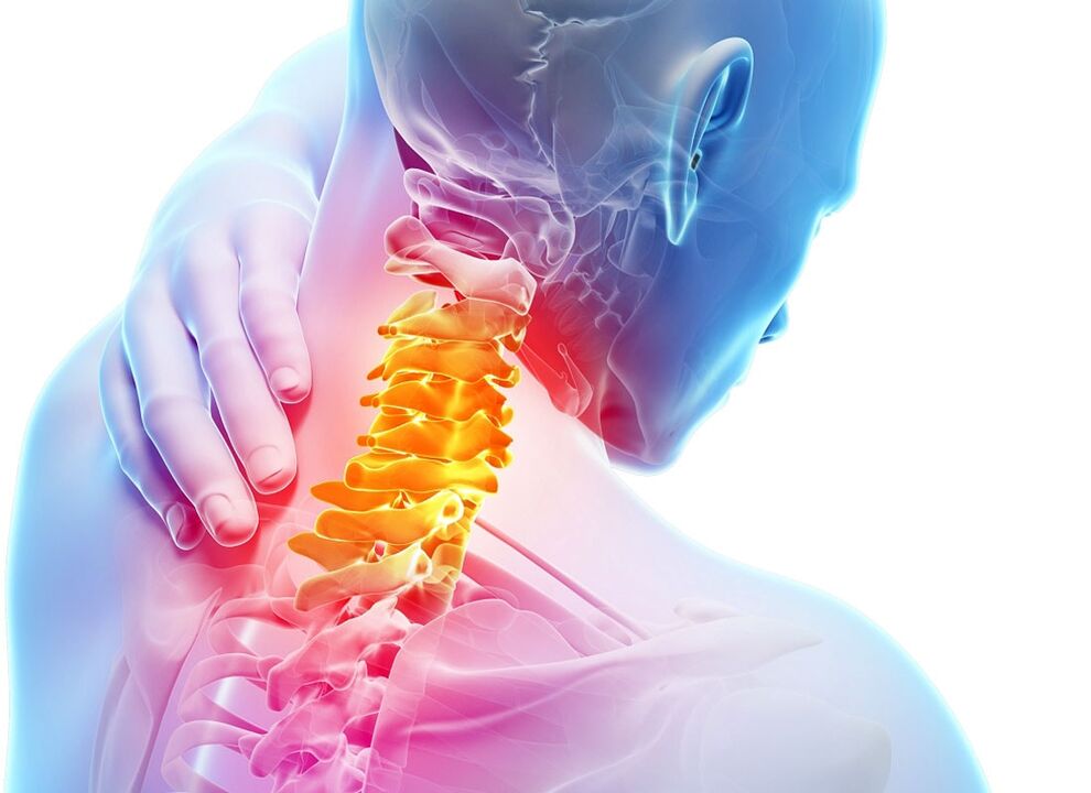 Síntomas da osteocondrose cervical